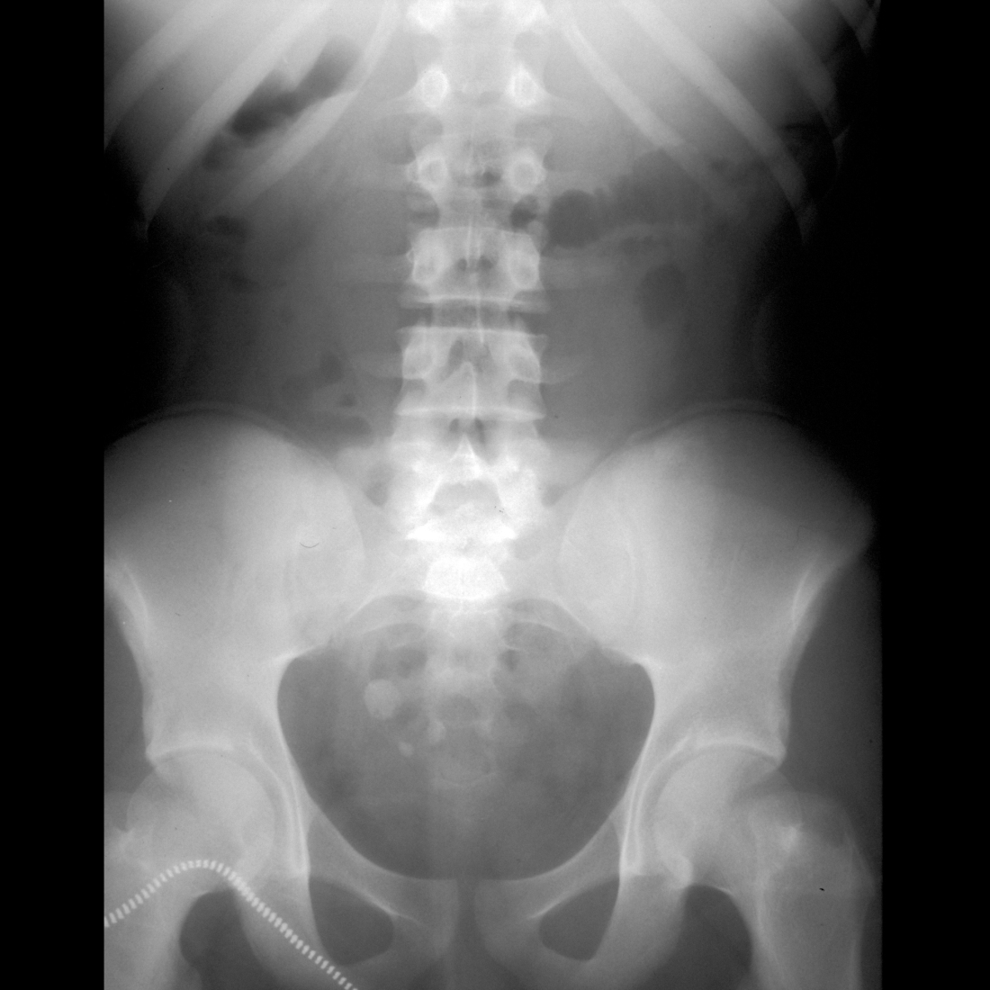 Teenager with abdominal pain