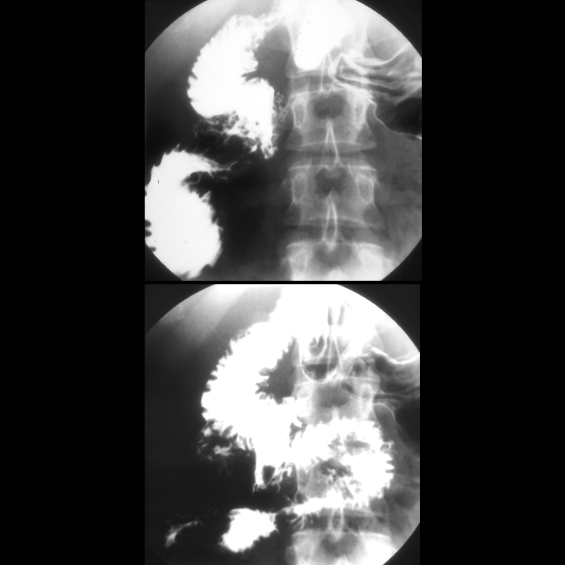 Teenager with chronic vomiting